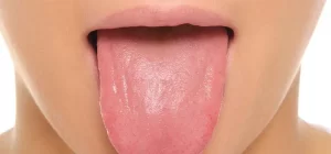 Advances in automated tongue diagnosis techniques